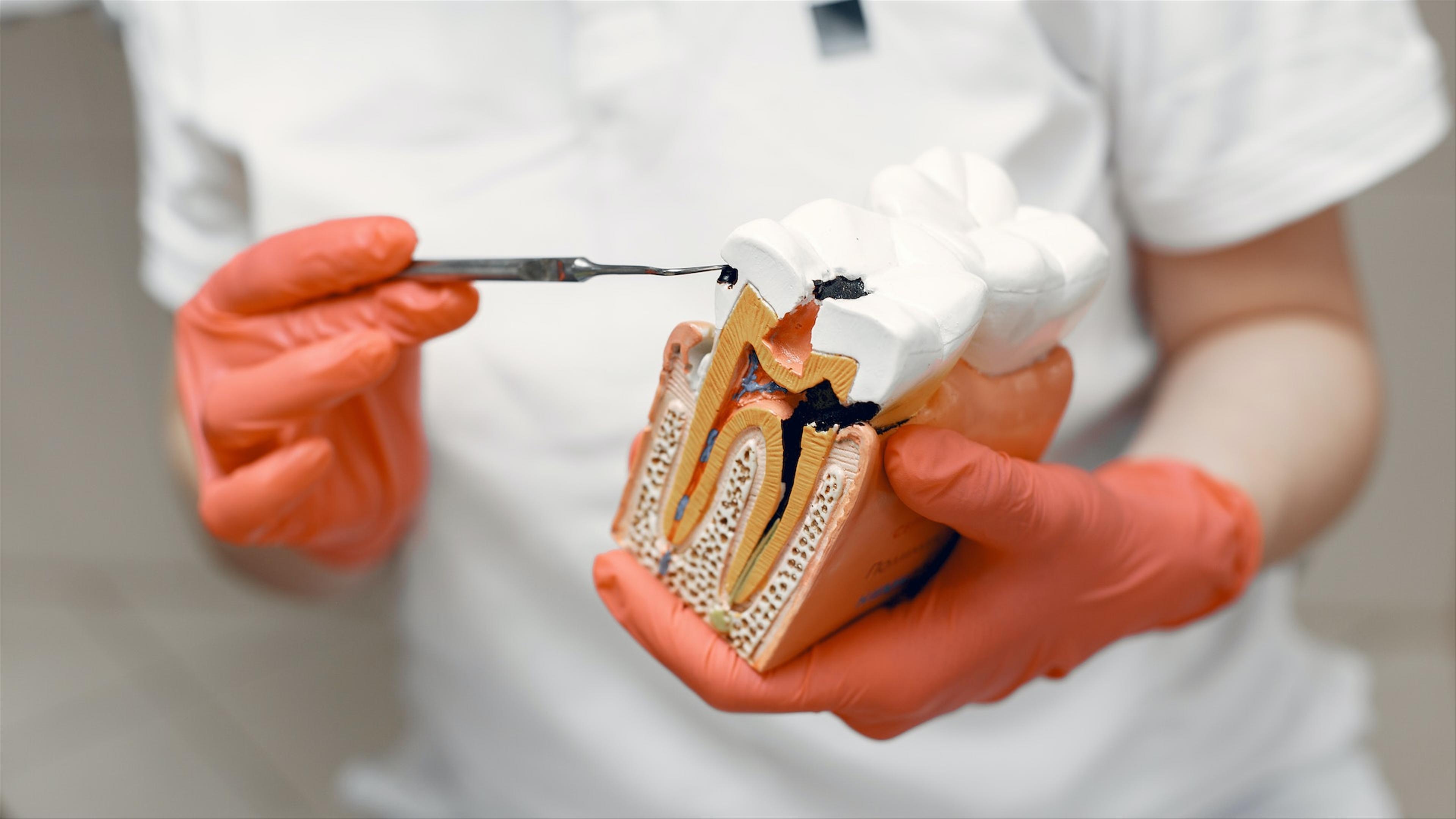 Dentist performing a root canal treatment